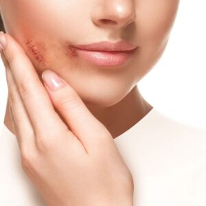 کرم ترمیم کننده ژیناژن